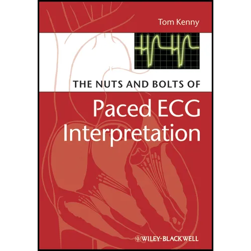 The Nuts and Bolts of Paced ECG Interpretation