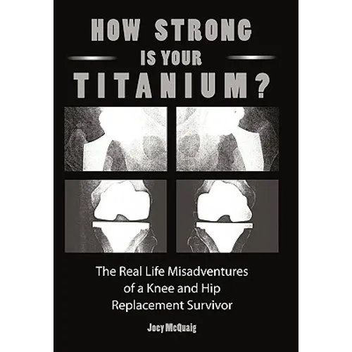 How Strong Is Your Titanium: The Real Life Misadventures of a Knee and Hip Replacement Survivor