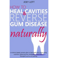 How to Heal Cavities and Reverse Gum Disease Naturally: a science-based, proven plan to heal teeth and gums using nutrition, balancing the metabolism,