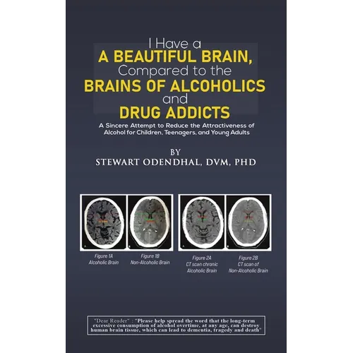 I Have a Beautiful Brain, Compared to the Brains of Alcoholics and Drug Addicts