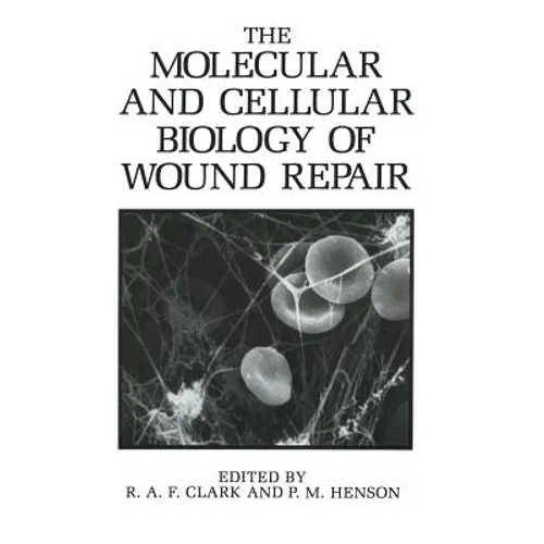 The Molecular and Cellular Biology of Wound Repair