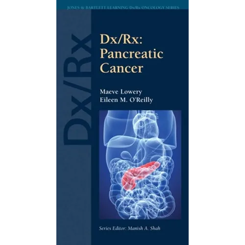 DX/Rx: Pancreatic Cancer: Pancreatic Cancer