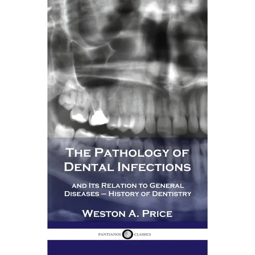 Pathology of Dental Infections: and Its Relation to General Diseases - History of Dentistry