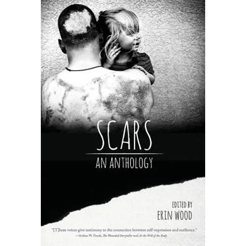 Scars: An Anthology