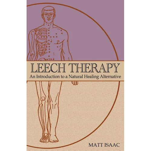 Leech Therapy: an introduction to a natural healing alternative
