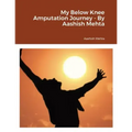 My Below Knee Amputation Journey - By Aashish Mehta