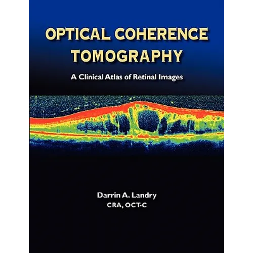 Optical Coherence Tomography a Clinical Atlas of Retinal Images