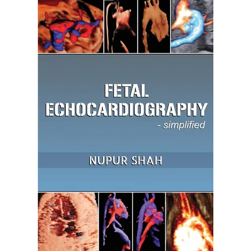 Fetal Echocardiography - Simplified