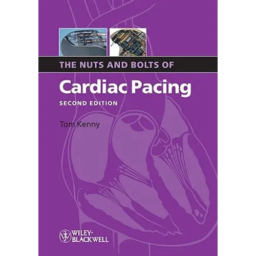Nuts Bolts Cardiac Pacing 2e