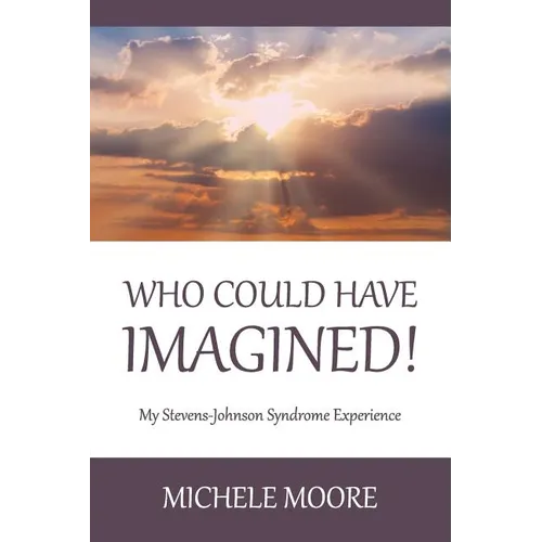Who Could Have Imagined!: My Stevens-Johnson Syndrome Experience