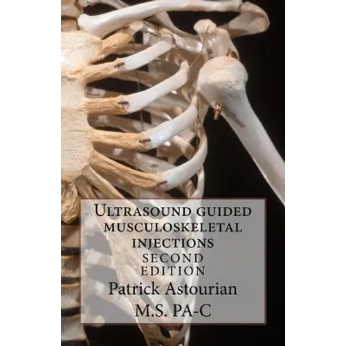 Ultrasound guided musculoskeletal injections