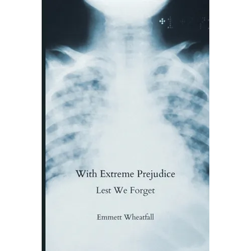 With Extreme Prejudice: Lest We Forget