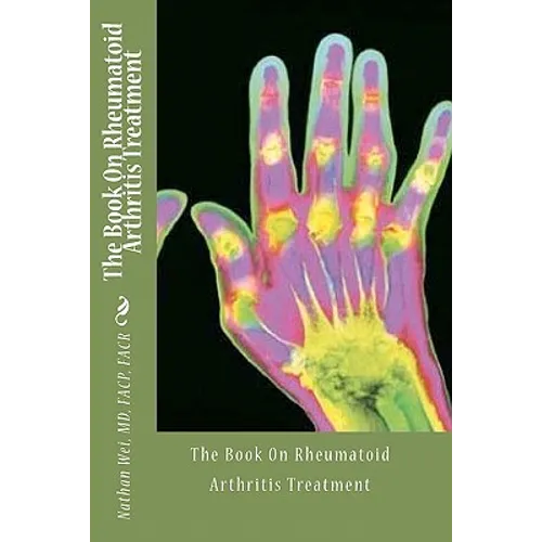 The Book On Rheumatoid Arthritis Treatment