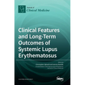 Clinical Features and Long-Term Outcomes of Systemic Lupus Erythematosus