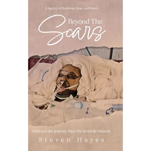 Beyond The Scars: A Journey of Resilience, Hope, and Power