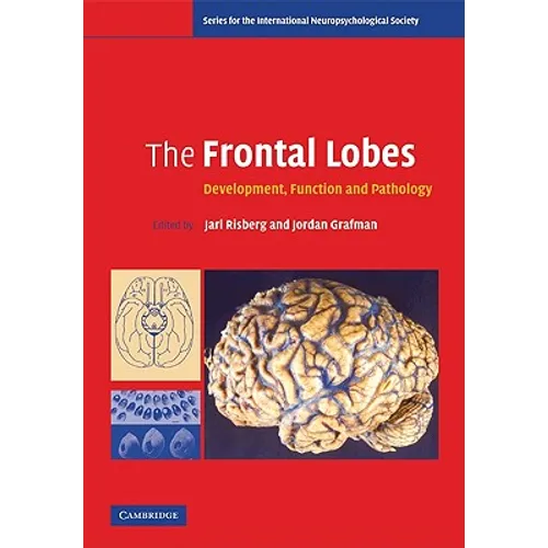 The Frontal Lobes