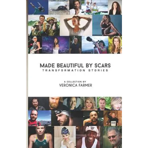 Made Beautiful by Scars: Transformation Stories